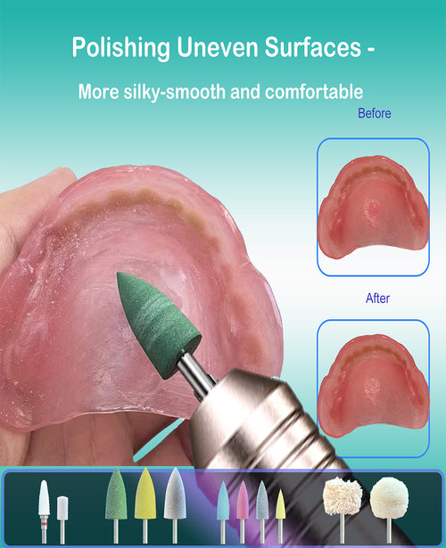 Cordless Polishing & Repair Kit for Acrylic Resin False Teeth | File Down Rough Edges, Sand Away Sore Spots, Adjust Reline, Remove Hardened Glue | USB Rechargeable & Beginner-Friendly