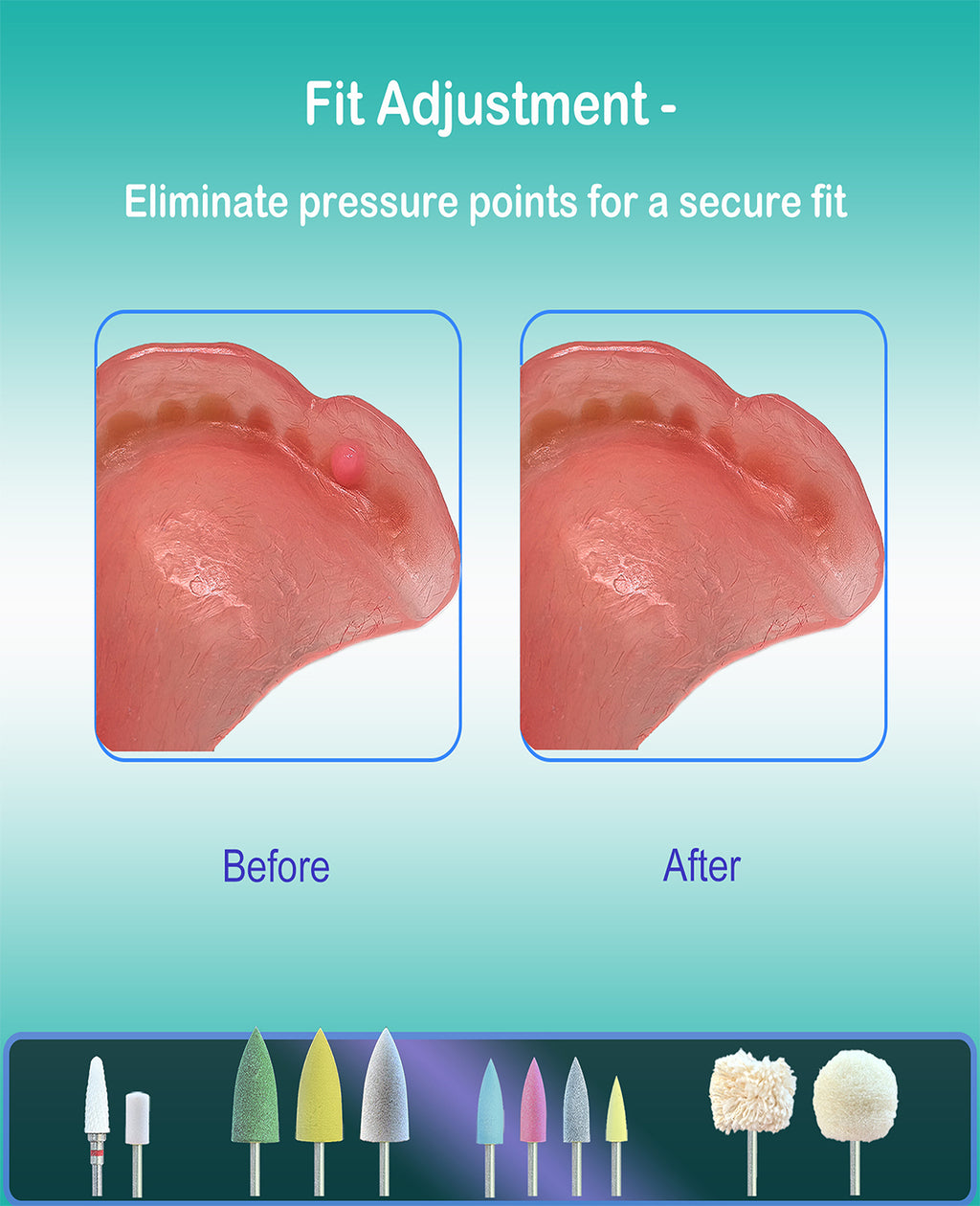Cordless Polishing & Repair Kit for Acrylic Resin False Teeth | File Down Rough Edges, Sand Away Sore Spots, Adjust Reline, Remove Hardened Glue | USB Rechargeable & Beginner-Friendly